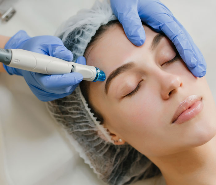 Dermapen